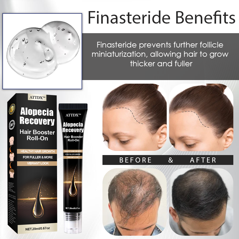 ATTDX™ Alopecia Recovery Hair Booster Roll-On