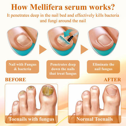 ATTDX™ AntiFungal Mellifera Venom Repair Serum