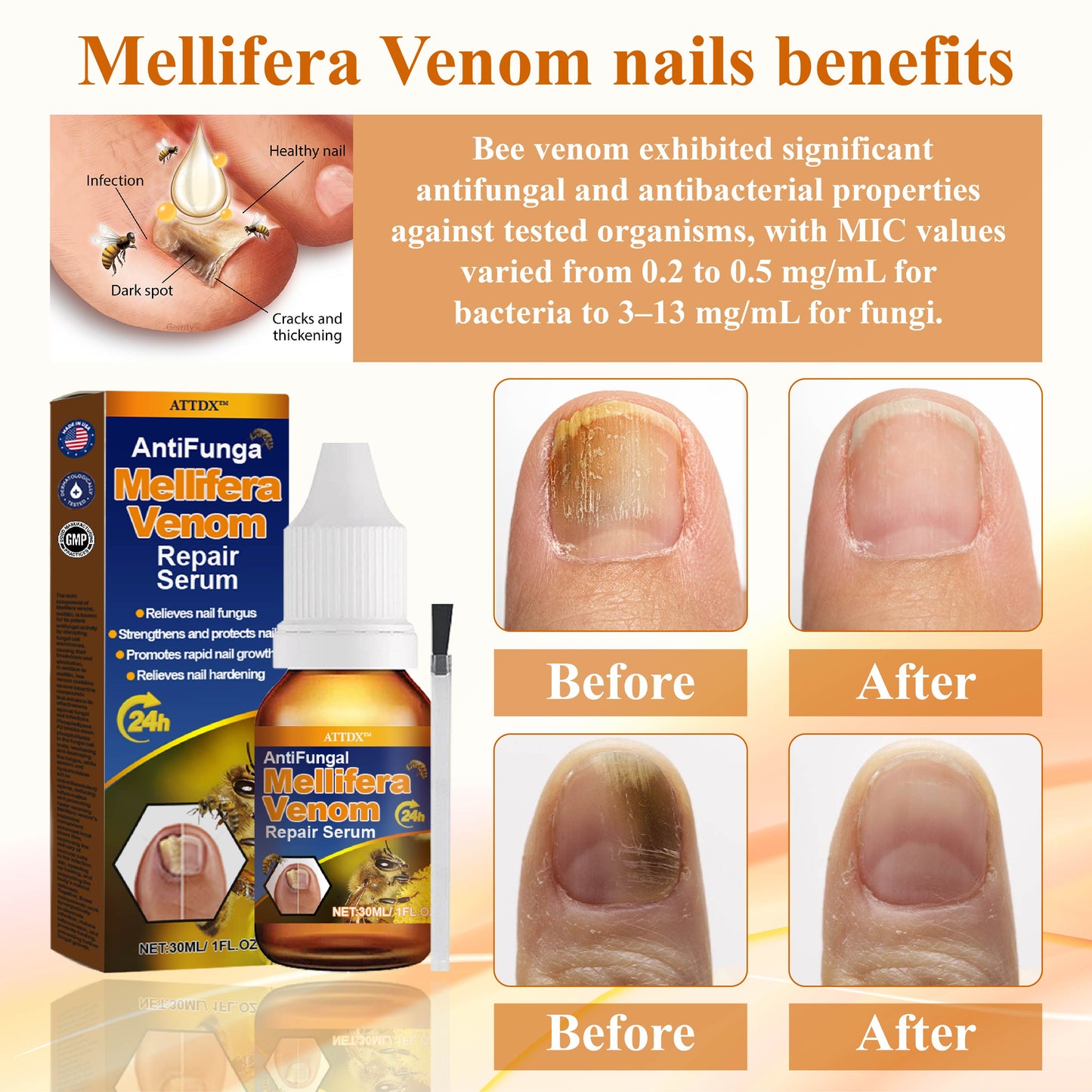 ATTDX™ AntiFungal Mellifera Venom Repair Serum