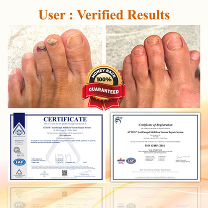 ATTDX™ AntiFungal Mellifera Venom Repair Serum