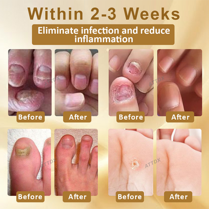 ATTDX™ AntiFungal Mellifera Venom Repair Serum