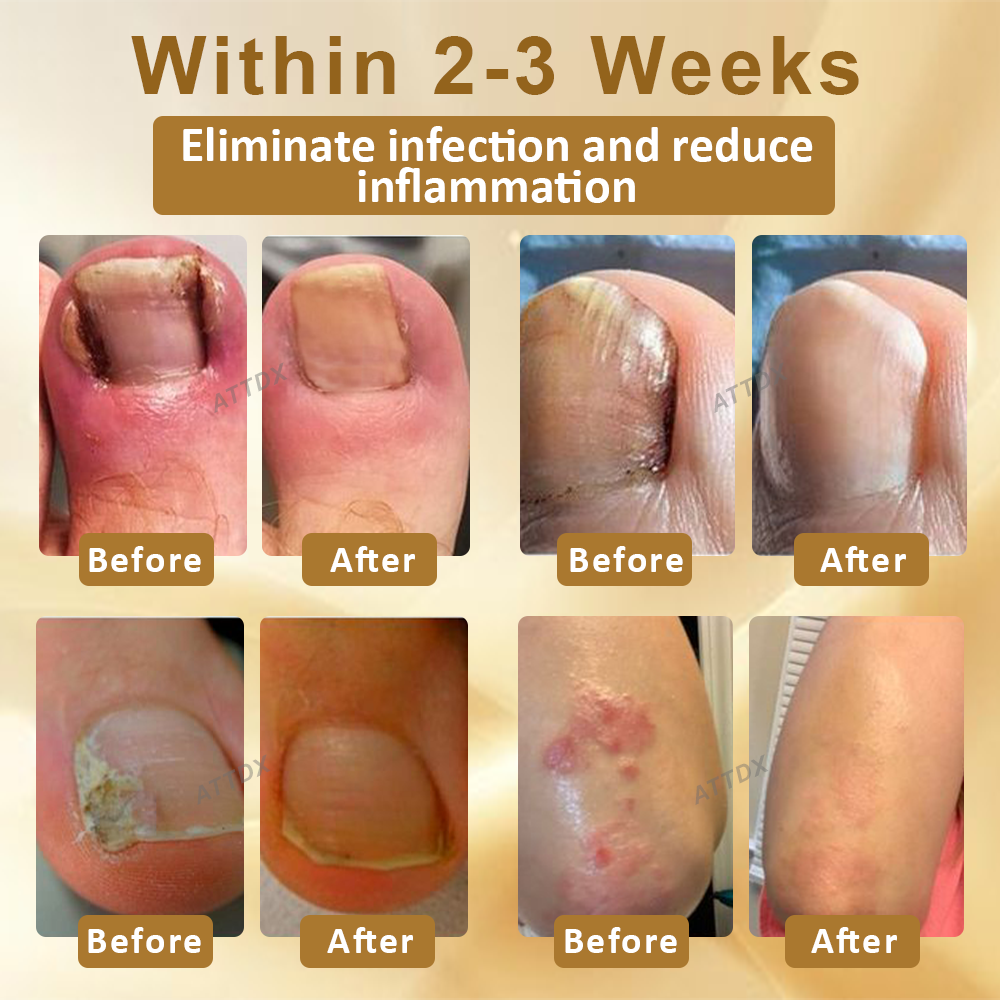 ATTDX™ AntiFungal Mellifera Venom Repair Serum
