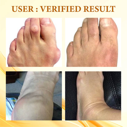 Bee Venom UricEase JointRelief Cream