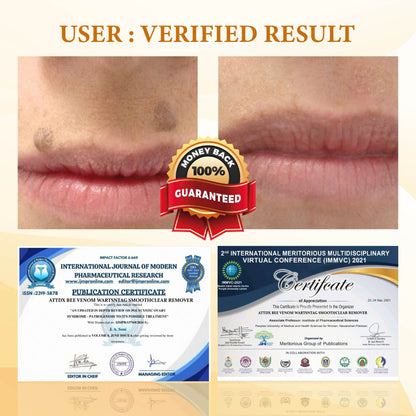 ATTDX™ Venomous Apitherapy Tag and Mole Removal Patches