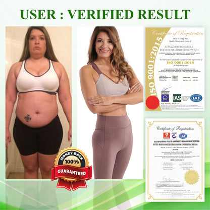 ATTDX™ Berberine HCL 500mg LipidBurn Capsules