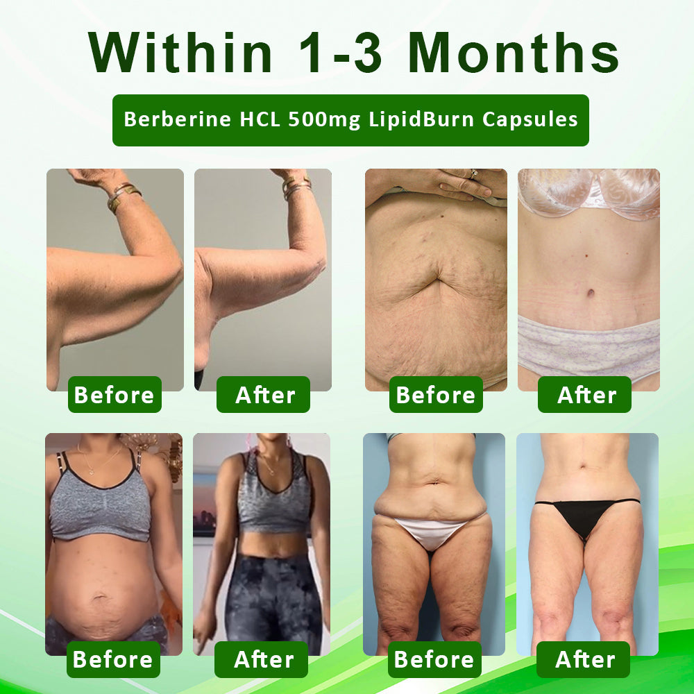 ATTDX™ Berberine HCL 500mg LipidBurn Capsules