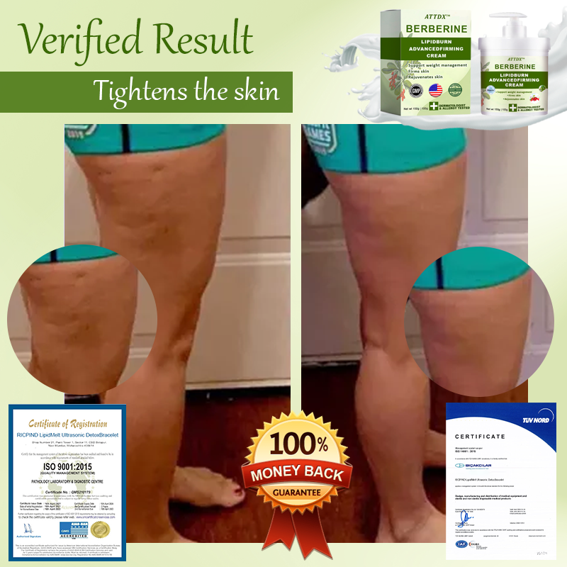 ATTDX™ Berberine LipidBurn AdvancedFirming Cream