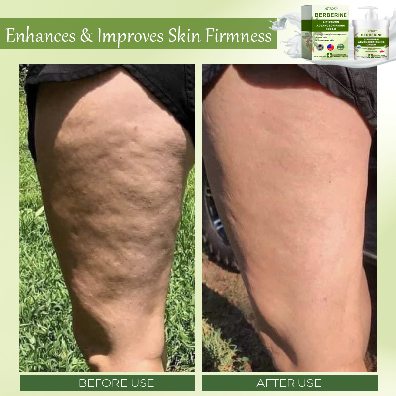 ATTDX™ Berberine LipidBurn AdvancedFirming Cream