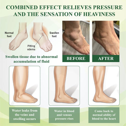 ATTDX® PuffyGone Horse Chestnut Edema Cream