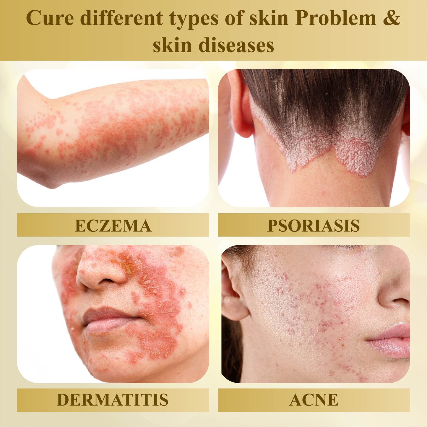 ATTDX™ Condense Mellifera Venom Skin Repairing Cream