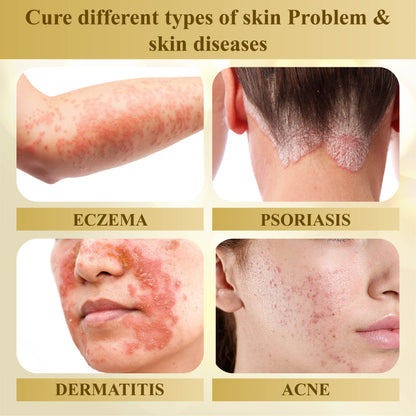 ATTDX™ Condense Mellifera Venom Skin Repairing Cream