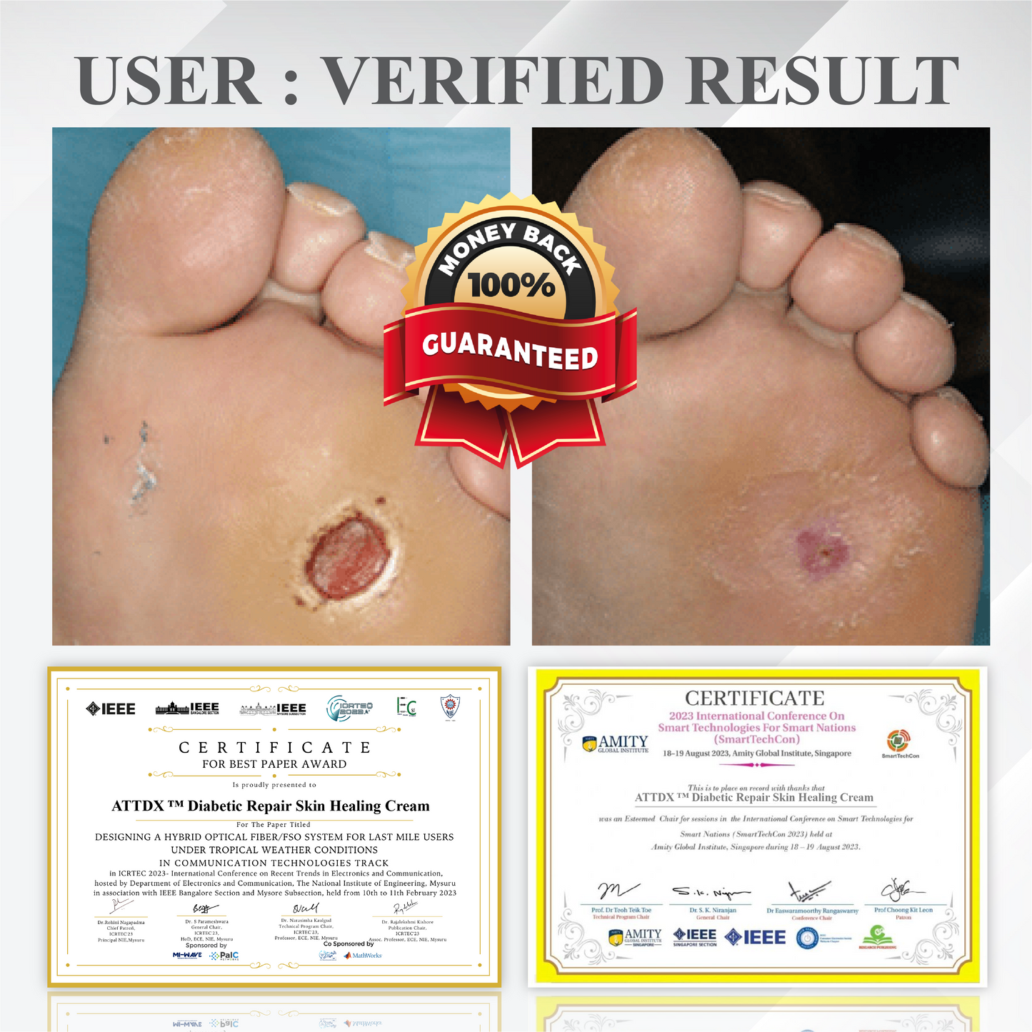 ATTDX™ Diabetic Repair Skin Healing Cream