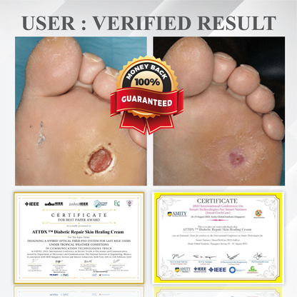 ATTDX™ Diabetic Repair Skin Healing Cream