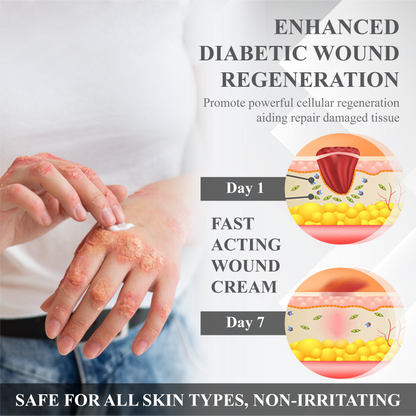 ATTDX™ Diabetic Repair Skin Healing Cream
