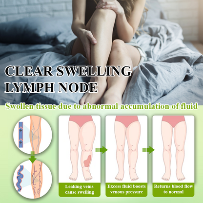 ATTDX® FluidiQ Edema Support Spray