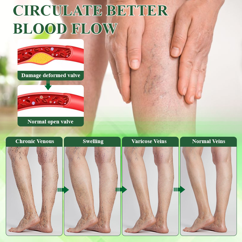 ATTDX HerbalDrain Edema Comfort Massage Cream abi09 2