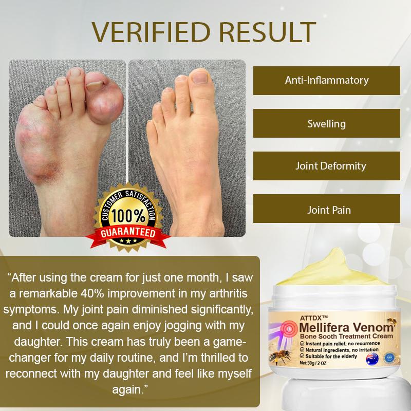 ATTDX™ Mellifera Venom BoneSooth DX Treatment Cream