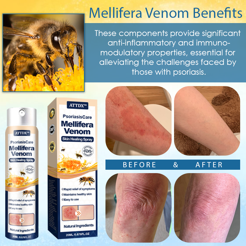 ATTDX™ PsoriasisCare Mellifera Venom Skin Healing Spray