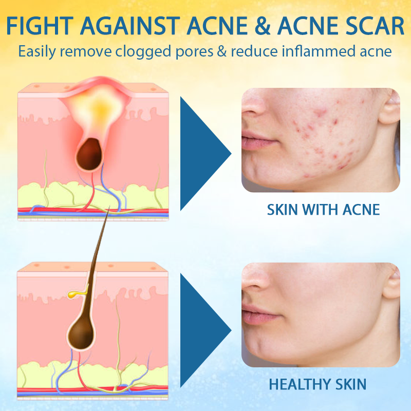 ATTDX™ PsoriasisCare Mellifera Venom Skin Healing Spray