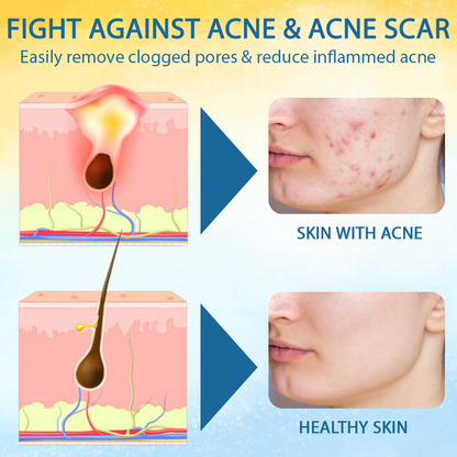 ATTDX™ PsoriasisCare Mellifera Venom Skin Healing Spray