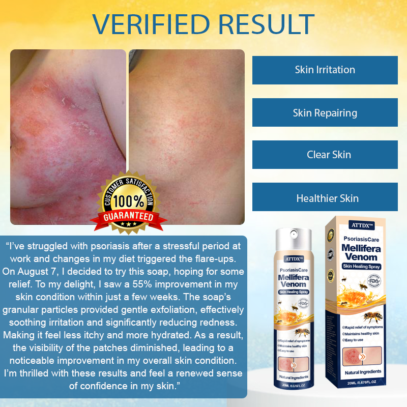 ATTDX™ PsoriasisCare Mellifera Venom Skin Healing Spray
