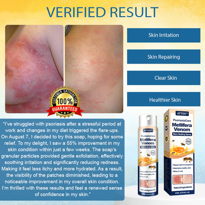 ATTDX™ PsoriasisCare Mellifera Venom Skin Healing Spray