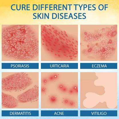 ATTDX™ PsoriasisCare Mellifera Venom Skin Healing Spray