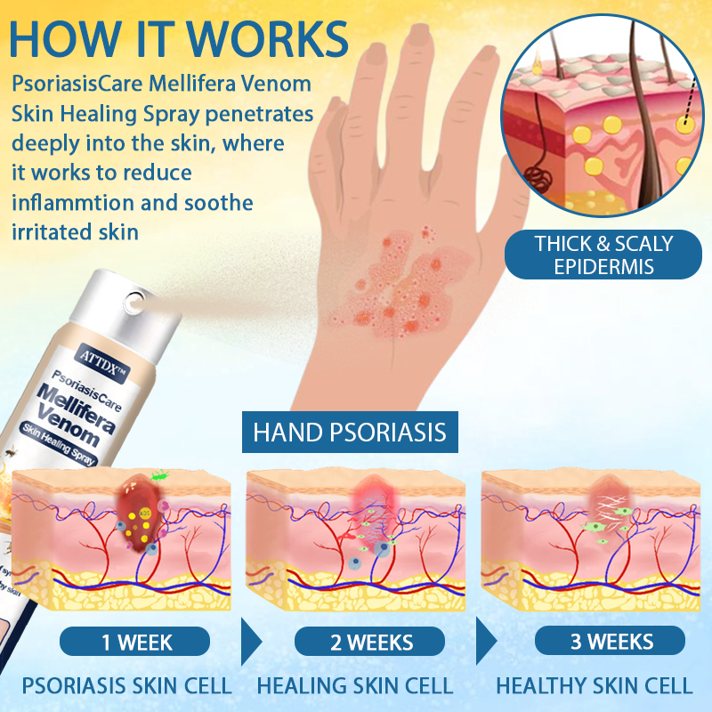 ATTDX™ PsoriasisCare Mellifera Venom Skin Healing Spray