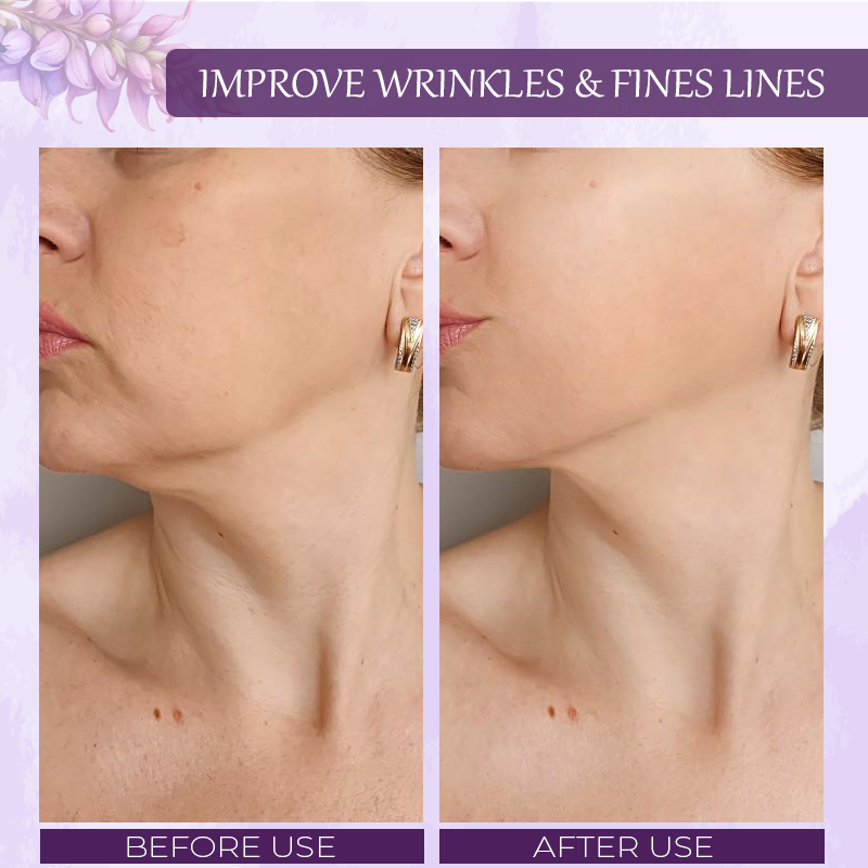 ATTDX™ Pueraria Flower Hydration SkinFirming Cream