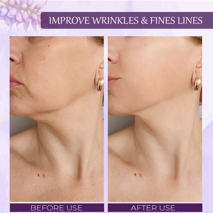 ATTDX™ Pueraria Flower Hydration SkinFirming Cream