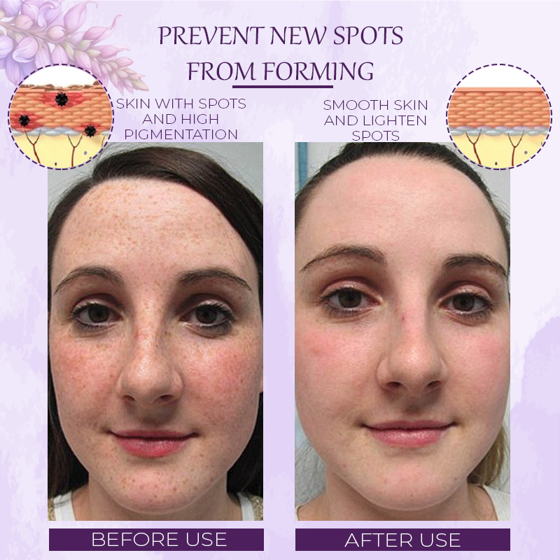 ATTDX™ Pueraria Flower Hydration SkinFirming Cream