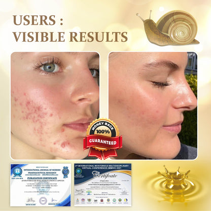 PureGlow Snail Filtrate Essence Capsules