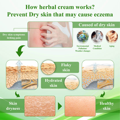 ATTDX™ Resurrection Grass Skin Soothing Herbal Cream