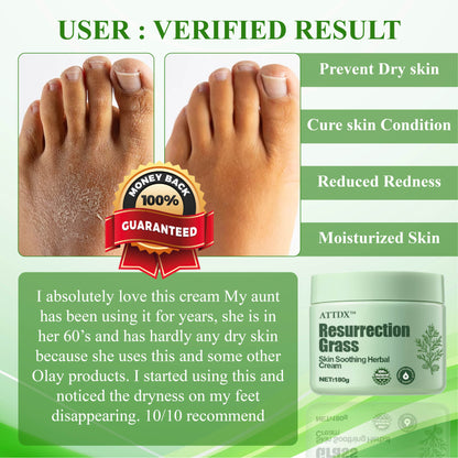 ATTDX™ Resurrection Grass Skin Soothing Herbal Cream