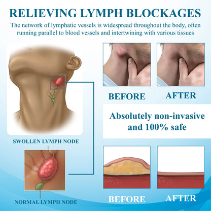 ATTDX™ SwellingEase Lymphatic Drainage Massage Cream