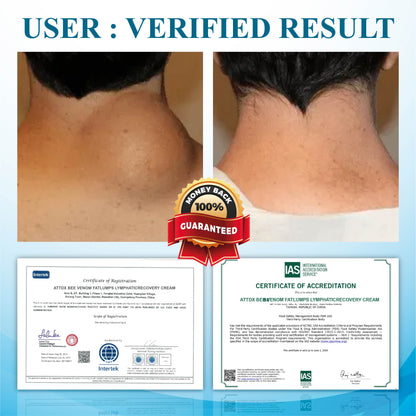 ATTDX™ SwellingEase Lymphatic Drainage Massage Cream