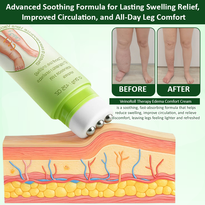 ATTDX VeinoRoll Therapy Edema Comfort Cream abi08 1