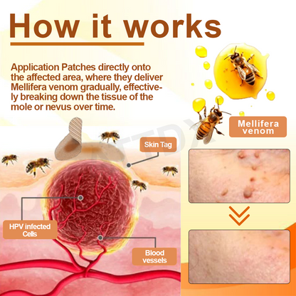 ATTDX™ Venomous Apitherapy Tag and Mole Removal Patches