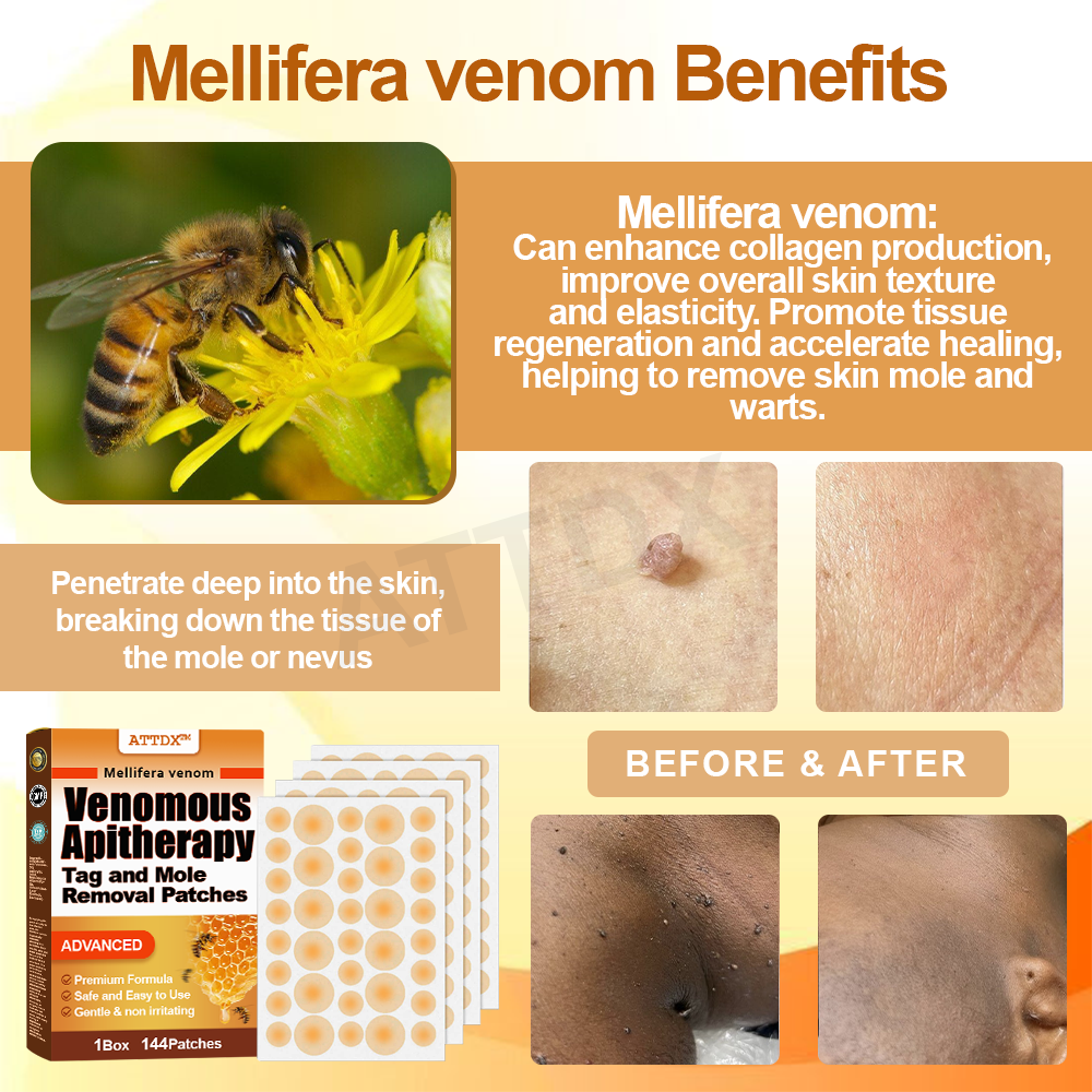 ATTDX™ Venomous Apitherapy Tag and Mole Removal Patches