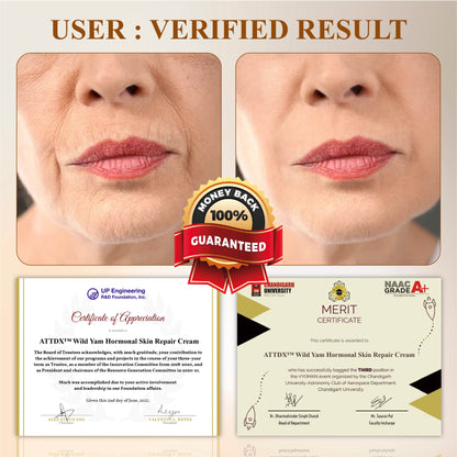 ATTDX™ Wild Yam Hormonal Skin Repair Cream
