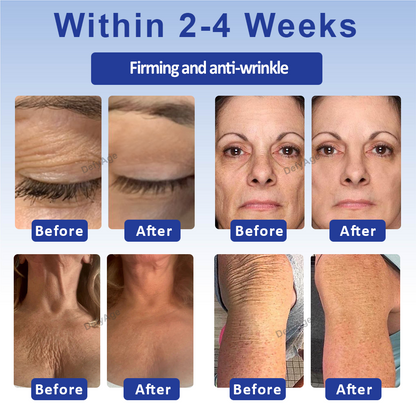 DefyAge™ WrinklesErase Roll On FirmingCream