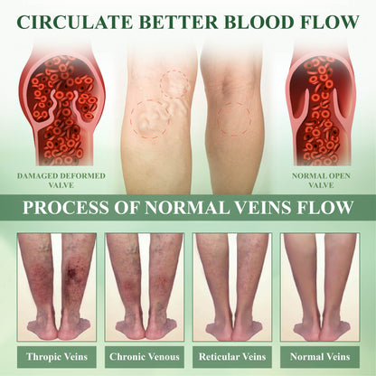 ATTDX® FluidEase Leg Therapy Edema Cream