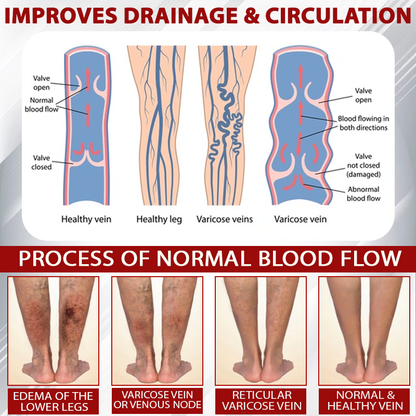 ATTDX® Advanced CVI Edema Therapy Cream