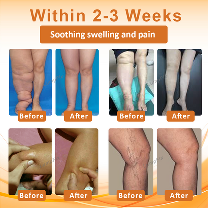 LumpFix™ Apis Venom LymphSupport Roll On
