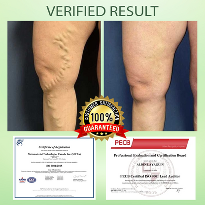 RICPIND™ Circulation Max Tourmaline Fiber Leg Sleeves