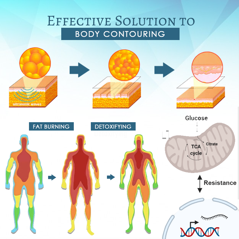 Ultrasonic Tech LipidBlast DetoxBracelets