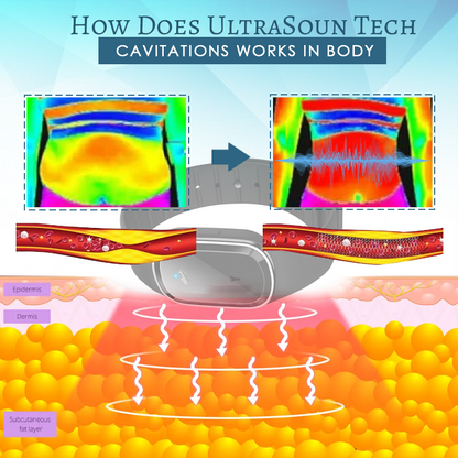 Ultrasonic Tech LipidBlast DetoxBracelets
