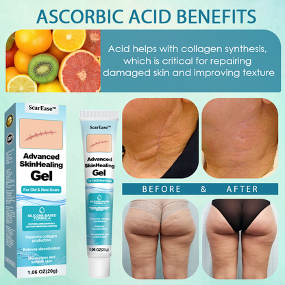 ScarEase™ Advanced SkinHealing Gel