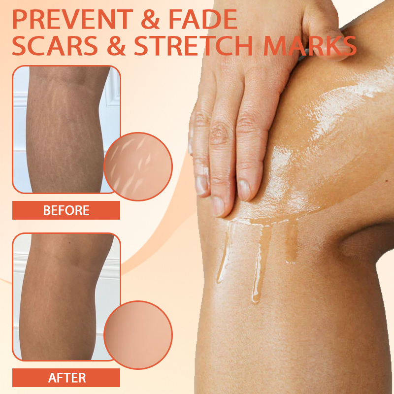 TightenLift™ SkinFirming and ScarRepair Oil
