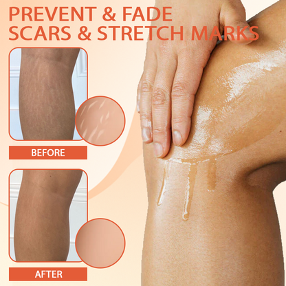 TightenLift™ SkinFirming and ScarRepair Oil
